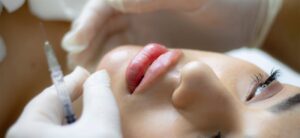 aumento-de-labios-aspectos-claves